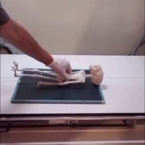 The supposed beings, presented by Jaime Maussan, have 3 fingers on each hand and each foot, each finger has 6 phalanges